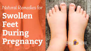 Swollen Feet During Pregnancy Natural Remedies