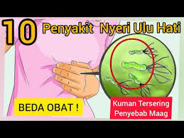 Kadangkala, pada kasus sakit ulu hati yang terjadi secara signifikan, ini dapat menjadi tanda dari preeklampsia. Beda Obat 10 Penyakit Penyebab Nyeri Ulu Hati Lambung Perih Dada Panas Perut Atas Tertusuk Youtube