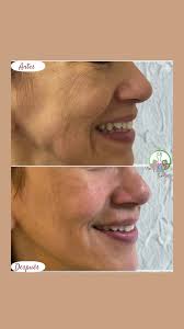 ✨ Tu piel merece lo mejor de la ciencia y la naturaleza ✨, Descubre el  poder del PDRN de salmón potenciando con Ácido Hialuronico + Niacidamina;  Regenera, hidrata y rejuvenece tu piel desde su ...