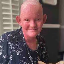 Fundraiser by jodie lacey : Help Cassidy's Journey