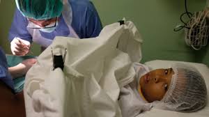 Paling famous dalam google adalah klinik ajwa seksyen 7 shah alam. Mengenal 3 Metode Sunat Lebih Baik Mana Untuk Anak Kumparan Com