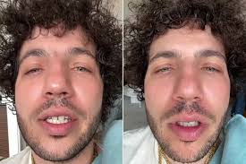 Benny Blanco Plucks His Unruly Eyebrows and Fans Are Jokingly Calling It  the 'Fiancée Effect'