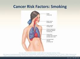 The laryngoscopy is used to view the. How Many Years Does One Smoke Before They Develop A Hole In Their Throat Can It Happen In Someone S Twenties Quora