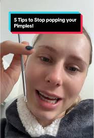 5 Essential Tips to Stop Popping Pimples