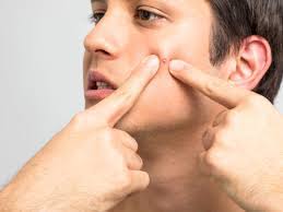 Die besten home laufbänder für läufer. Treat Pimples 3 Ways To Get Rid Of A Pimple Fast How To Get Rid Of A Pimple Overnight