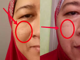 Ia sangat bagus dalam menegangkan kulit muka anda. Dengan Bajet Tak Sampai Rm20 Anda Masih Boleh Dapatkan Kulit Yang Flawless Blackhead Pun Boleh Hilang Petua Ibu