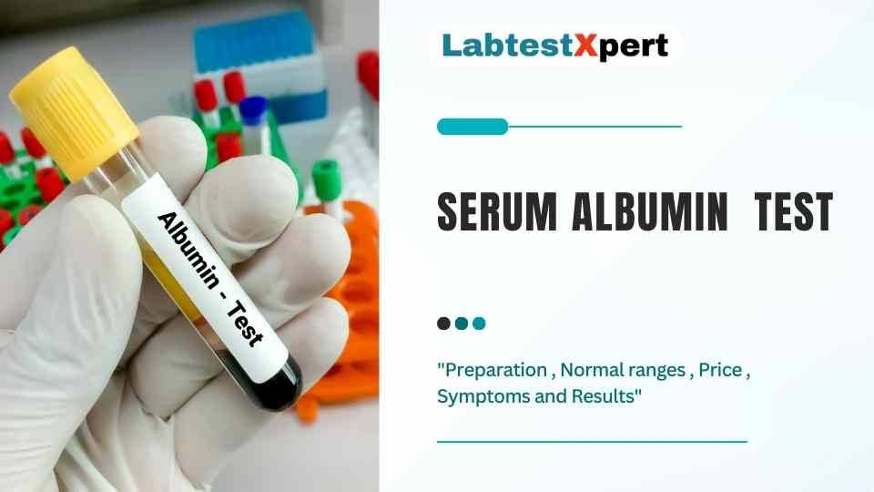 ALBUMIN - SERUM product image
