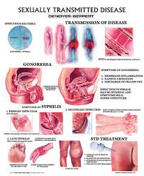 sexually transmitted disease wall chart unmounted amazon