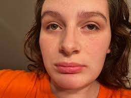 OK so I have been getting rashes for a very long time. Usually