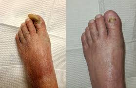 Find a doctor within the carecredit network to begin your healthcare visits. Podiatry Services In Atlanta Ga Atlanta Family Foot Care