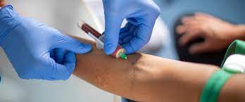 9,42 € + anfahrtspauschale 6,91 €). Mylab Bietet In Kooperation Mit Partnerlabors Jede Laborleistung