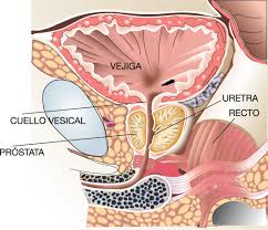La prostata, detta anche ghiandola prostatica, è una ghiandola dell'apparato genitale maschile situata sotto la vescica. Acerca De La Prostata Y Sus Enfermedades Centro Gil Vernet De Urologia