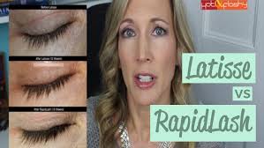 Ersetze kunstwimpern mit natürlich langen, dichten wimpern! Rapidlash Vs Latisse Which One Wins Eyelash Growth Com