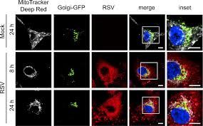 Help protect yourself and your loved ones from rsv infection. Respiratory Syncytial Virus Co Opts Host Mitochondrial Function To Favour Infectious Virus Production Elife