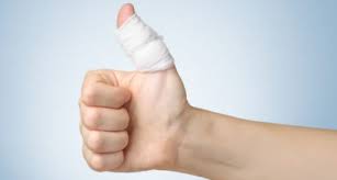 In a mild wrist sprain, your wrist may be slightly swollen and tender, and you probably will feel some mild pain when you move it. Is My Thumb Broken Or Sprained Complete Care