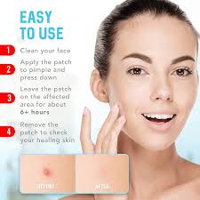 Pimples do not discriminate, and before you get tempted to use your fingers to pop it, let me introduce you to some of the best korean pimple. Buy Acne Patches 120 Pack Hydrocolloid Acne Patch With Tea Tree Oil Pimple Patches For Face Zit Patch And Pimple Stickers Hydrocolloid Acne Dots For Healing Acne With Zit