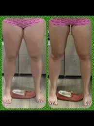 Pin On Skin Tightening After Weight Loss