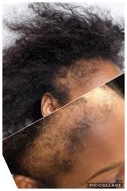 Francis recommends avoiding formulas with harmful sulfates that can strip your hair of the natural and. Wigs Helpful Vs Harmful Wigs Are They Protecting Your Hair Or By The Natural Hair Confidant Medium