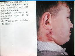 EVALUATION AND TREATMENT OF THE PATINT WITH A NECK MASS A slide lecture  series of the American academy of the otolaryngology