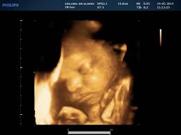 62 recenzije Privatna ginekološka ordinacija Mirjana Glavaš (Liječnik) u  Osijek (Osječko-baranjska)