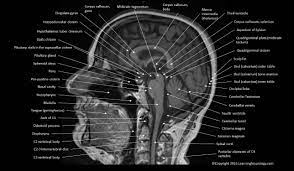 Normal Anatomy Of Brain Mri Tum Mri Brain Brain Anatomy Mri