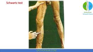 Image result for Venous Tap Test