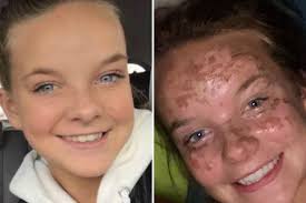 Fundraiser by Liza Gaspar : Relief Fund for Autumn Gaspar and Family