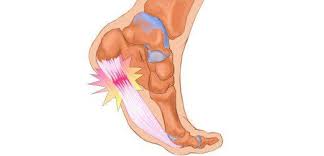 Finding The Perfect Shoes For Your Feet Will Be A Trial And Error Process Plantar Fasciitis Exercises Plantar Fasciitis Night Splint Plantar Fasciitis