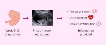 Image result for First Trimester Ultrasound