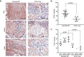 There are a number of sources of practical support and help at home available for women diagnosed with ovarian cancer. Evaluation Of The Association Of Heterozygous Germline Variants In Nthl1 With Breast Cancer Predisposition An International Multi Center Study Of 47 180 Subjects Npj Breast Cancer