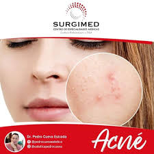 Mi Ciudad Prensa y Radio