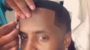 On 12/30/2016 at 3:02 pm, ashjung said: Safaree Shows Fake Hairline Up Close And Says You Can Get One Too Hip Hop Lately
