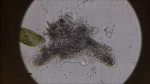 Tests to differentiate these species are not yet widely available in laboratories. The Blob Amoeba Proteus Under The Microscope Youtube