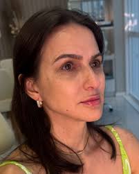 Histórias reais, resultados naturais e mulheres que decidiram se  escolher!✨🤍