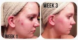 CreekBaby Spray orgánico de sal marina para cara, cuerpo y cabello, tóner  para acné, rosácea y volumen capilar : Belleza y Cuidado Personal