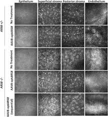 Image result for Silver Grey 1996 AAV