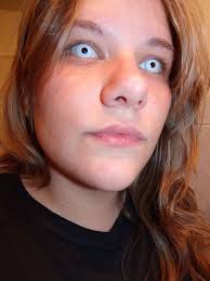 Over 15 years of lasik experience. All White Contact Lenses Crazy Colored Contact Lenses White Contact Lenses Halloween Contacts Contact Lenses Colored