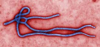 The first symptoms are usually fever, sore throat, muscle pain, and headaches. Ebola Ebola Virus Disease Cdc