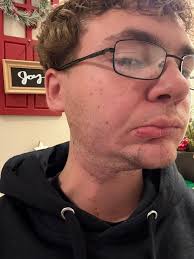 Which organ stores glycogen?