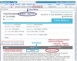 This means that we do not know at this time if antibodies make you immune to the virus. Understanding Your Spike Protein Antibody Blood Test Results Citymd