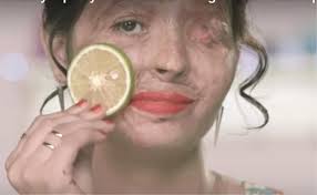 Sintesi acido solforico solforico utilizzato dei fertilizzanti, primariamente nella produzione di acido fosforico per attacco acido delle fosforiti. I Tutorial Di Trucco Di Reshma Ragazza Indiana Sfigurata Dall Acido Redattore Sociale