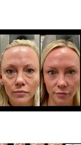 Ali Ghafouri, MD, FACS (@drghafourimd) · Instagram 照片和视频