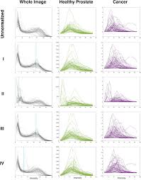 Pixel experience 9 pie rom. Effects Of Mri Image Normalization Techniques In Prostate Cancer Radiomics Physica Medica European Journal Of Medical Physics
