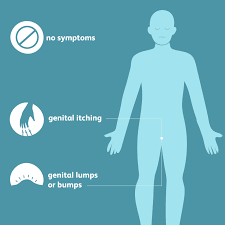 A pap smear can help detect changes in the cervix caused by hpv. Signs And Symptoms Of Human Papilloma Virus Infection