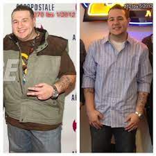 The final aim of gastric sleeve surgery is to achieve weight loss and after surgery that starts and with a diet after surgery. Chris Christie S Weight Loss Procedure New York Bariatric Group