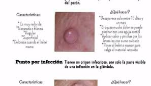 Pezones Irritados Durante La Lactancia Causas Y Soluciones Mujer Rd