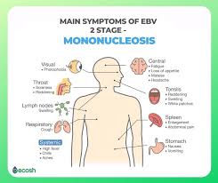 Rash enlarged spleen and a swollen liver are less common symptoms. Lupus What Disease Is It And What Causes It Ecosh Life