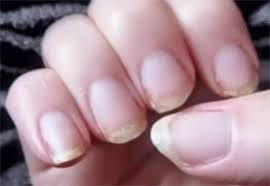 Tekorten Kenmerken Vrolijkweerzien