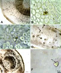 Kills harmful bacteria that has invaded by the cell membrane. Occurrence Types And Distribution Of Calcium Oxalate Crystals In Leaves And Stems Of Some Species Of Poisonous Plants Abstract Europe Pmc