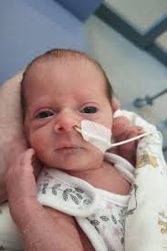 Baby Emily was only 2lb 8oz when she was born at 31 weeks